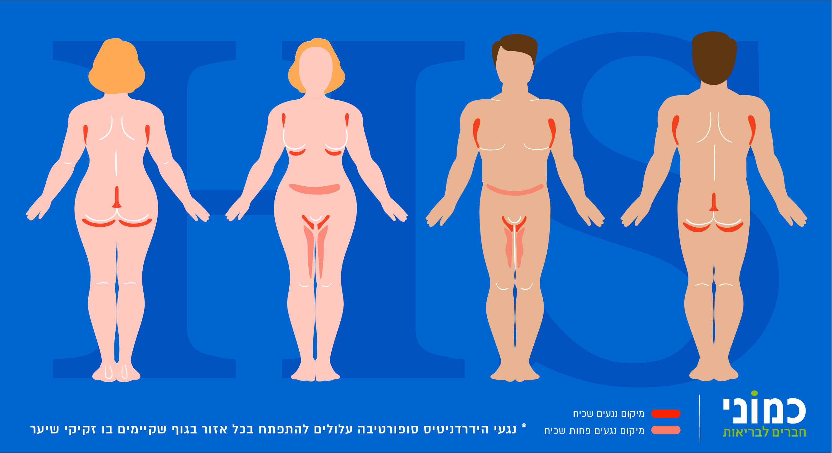  תסמינים של הידרדניטיס סופורטיבה HS Hidradenitis Suppurativa symptoms