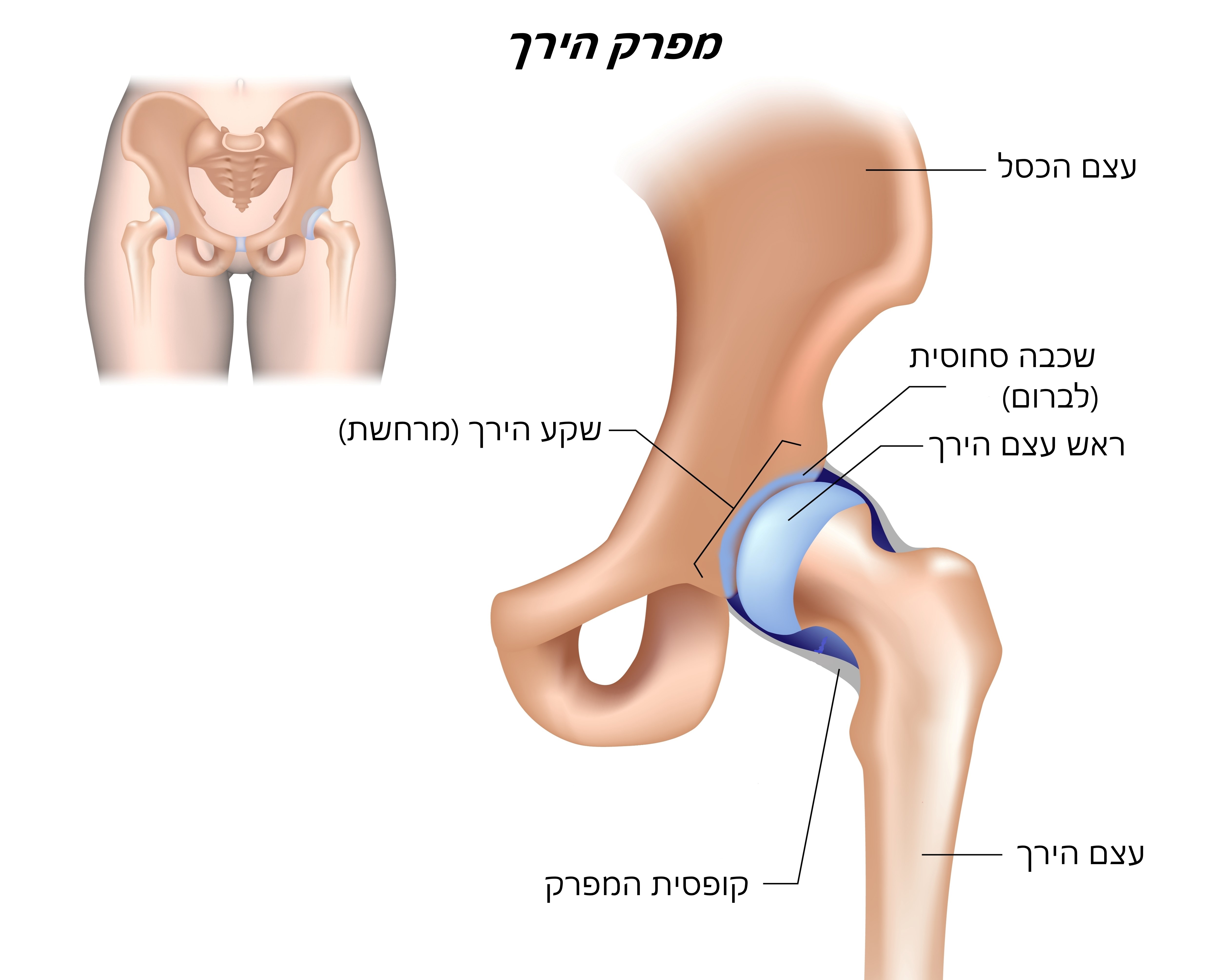 מפרק הירך