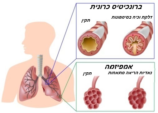 סוגי COPD - ברונכיטיס כרונית, אמפיזמה