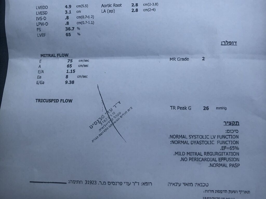 אקו לב