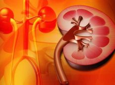 מחלת הכליות Minimal Changes Disease