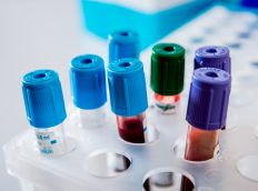 בדיקת המוגלובין מסוכרר (HbA1C)