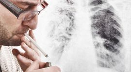כל הגורמים לסרטן הריאות