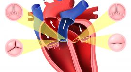 מחלות ובעיות במסתמי הלב – כל המידע 