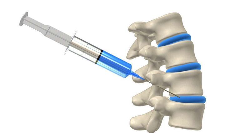 האם הזרקת תאי שוואן תרפא נפגעי חוט שדרה? (צילום: Shutterstock)