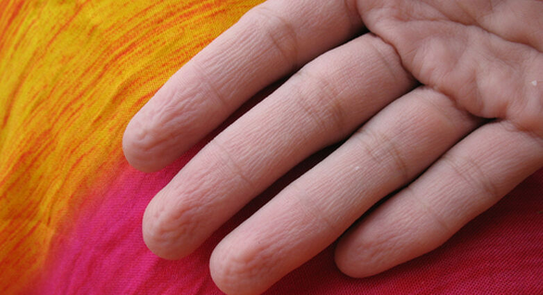 התקמטות של אצבעות רטובות: מנגנון עם מטרה (צילום: Shutterstock)