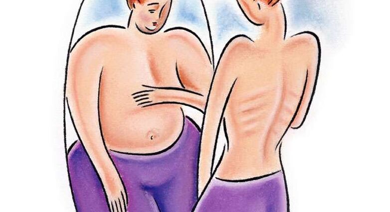 אסור להניח שמתבגרות במשקל תקין יודעות שהן במשקל תקין או שהן מרגישות טוב לגבי משקל גופן (צילום: אתר סטוק פוטוז)
