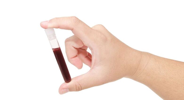 בדיקת דם פשוטה (צילום: Shutterstock)