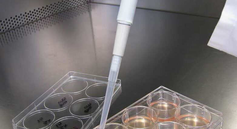 הזרקת נוגדנים לתאי גזע עשויה להקטין את הסיכון להיווצרות גידול (צילום:Shutterstock)