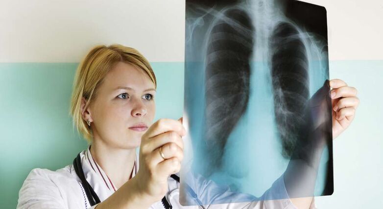 צילומי רנטגן לא יעילים כבדיקת סקר לאנשים ללא תסמינים (צילום: Shutterstock)