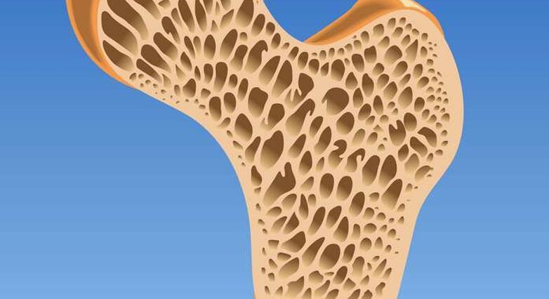 המכשיר יוצר שלד מלאכותי במבנה הרצוי, עליו גדלות רקמות עצם אמיתיות (צילום: Shutterstock)