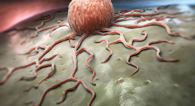 תקריב של תא סרטני (צילום: Shutterstock)