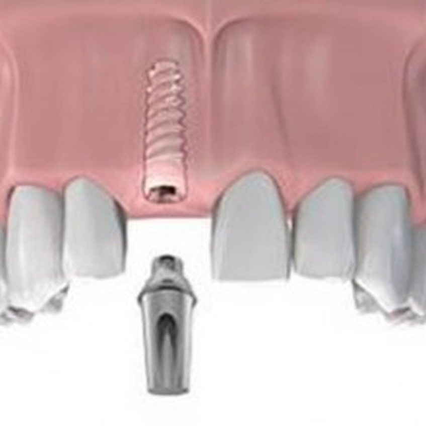רפואת שיניים בלייזר בטיפולים כירורגיים