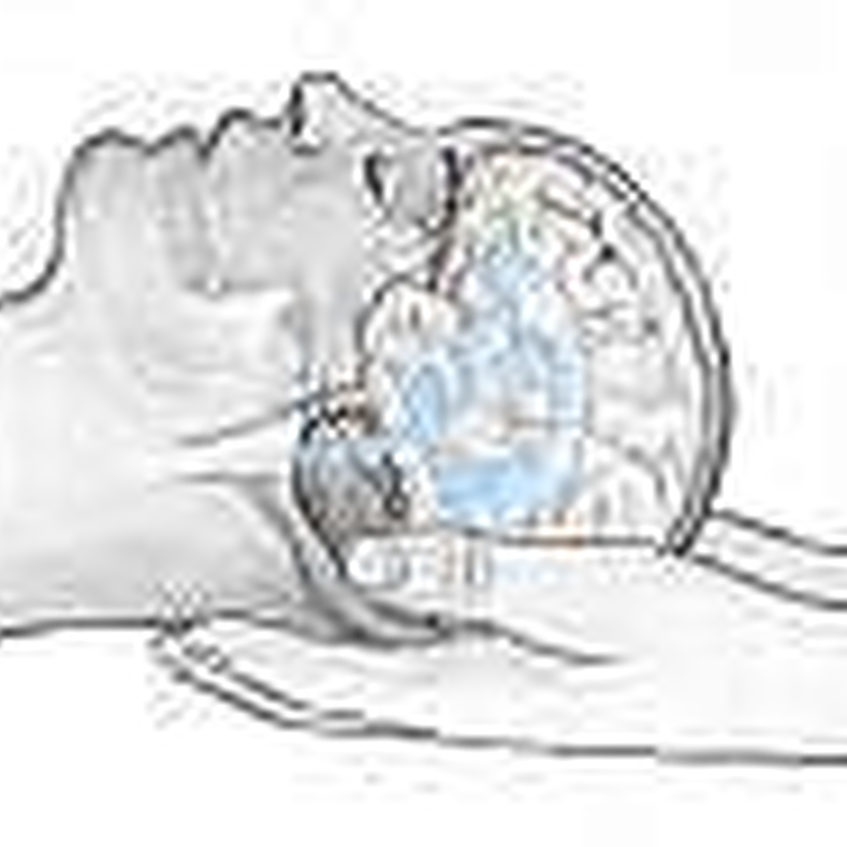 טיפול קרניוסקראל להקלה על כאבי ראש ומיגרנות