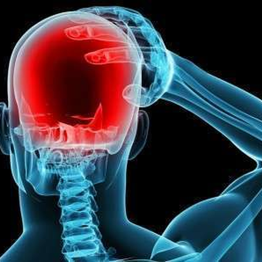 Mild electrical current found to prevent migraine attacks
