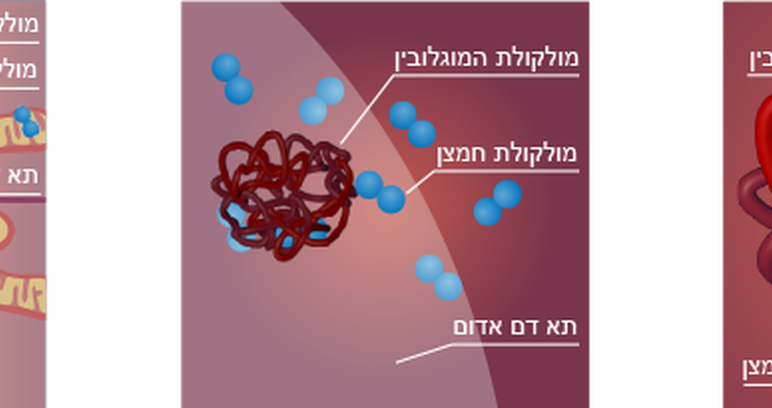 פסוריאזיס ליגמתי