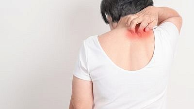 צילום: Shutterstock צילום: Shutterstock