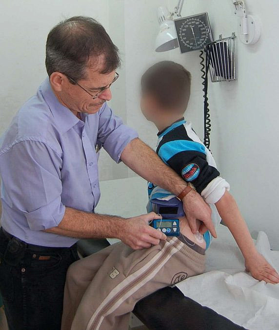דר צונג מחבר לילד הראשון את מד הסוכר הרציף למשאבת האינסולין שלו