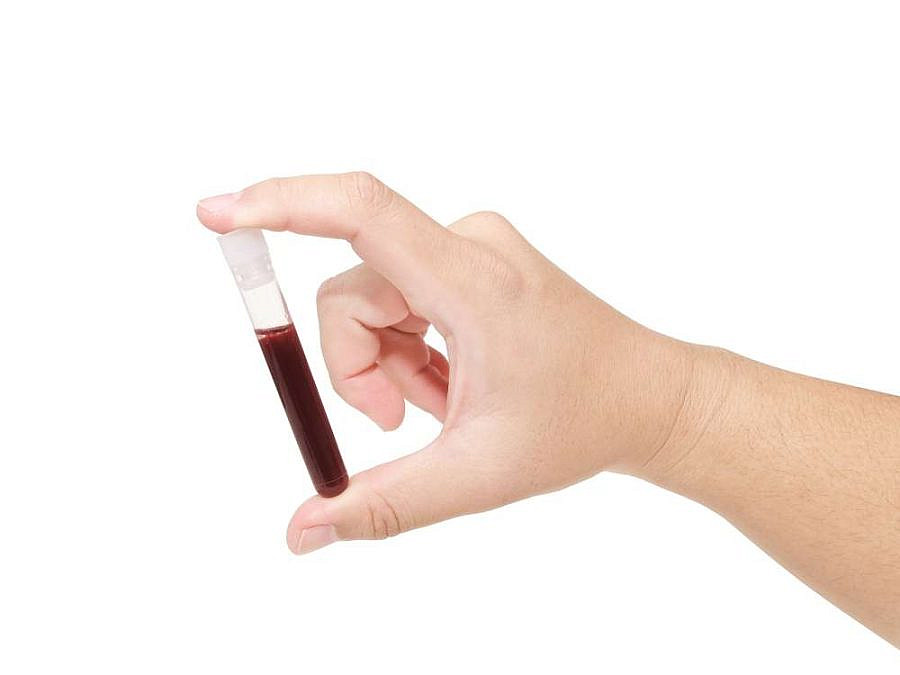 בדיקת דם פשוטה (צילום: Shutterstock) בדיקת דם פשוטה (צילום: Shutterstock)