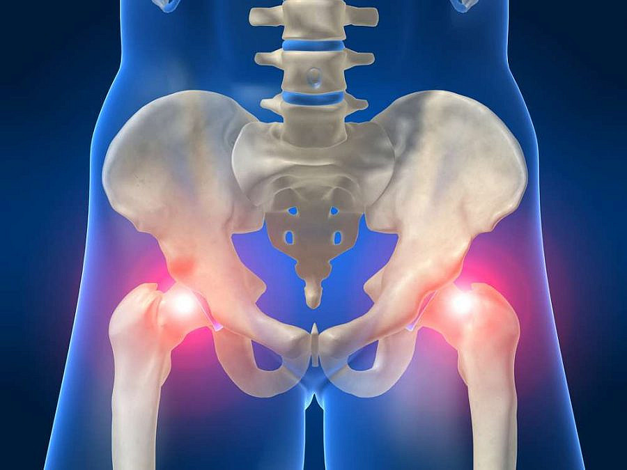 בחולות סוכרת עצם צוואר הירך פחות חזקה (צילום: Shutterstock)