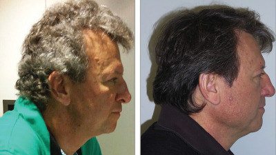 (צילום: JAMA Dermatology)