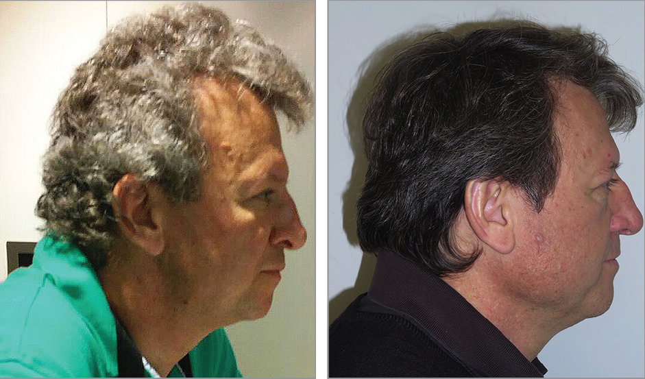 (צילום: JAMA Dermatology)