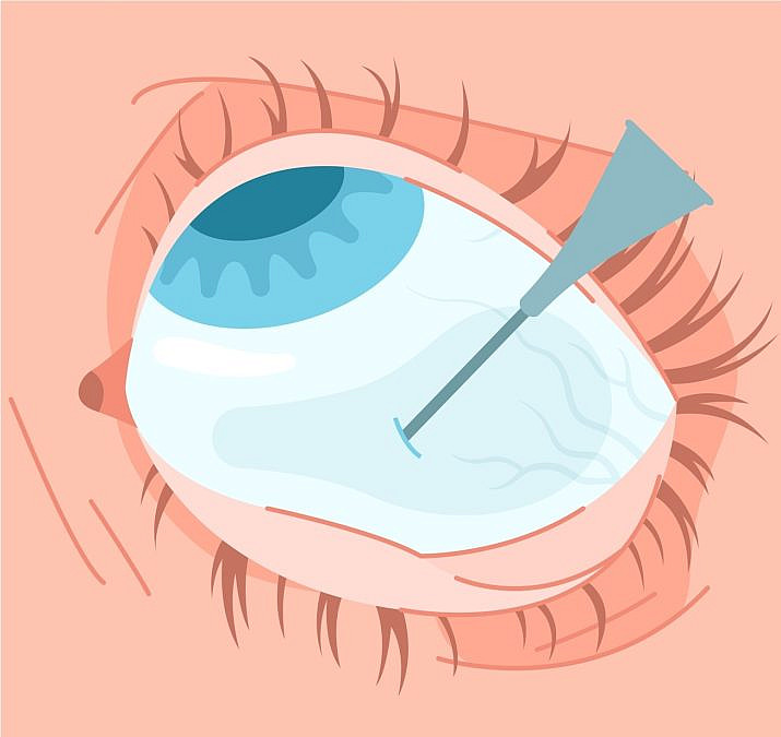 (איור: shutterstock) (איור: shutterstock)